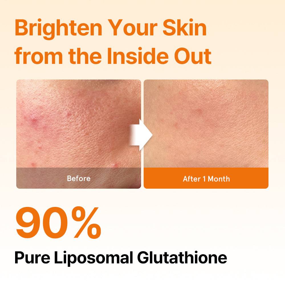 [Standard Pack] Liposomal Glutathione Direct – 30 Strips